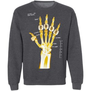 Kobe Bryant hand gold rings x-ray T-shirt, LS, Hoodie