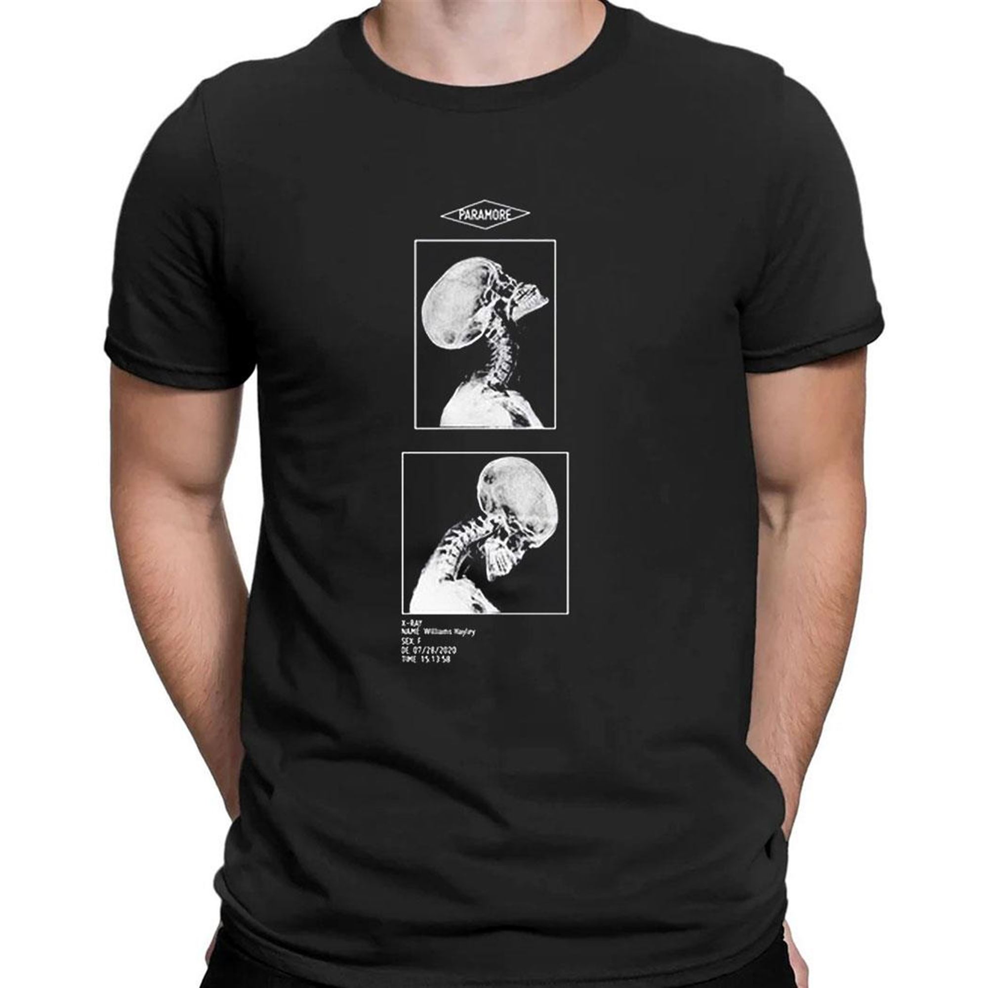 X Ray Williams Hayley Oh Doctors Order Excessive Head Banging May Lead To Spinal Fracture Shirt